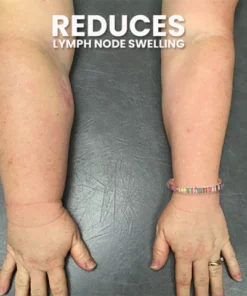 CrystalPower Lymph Drainage Magnetic Tourmaline Bracelet