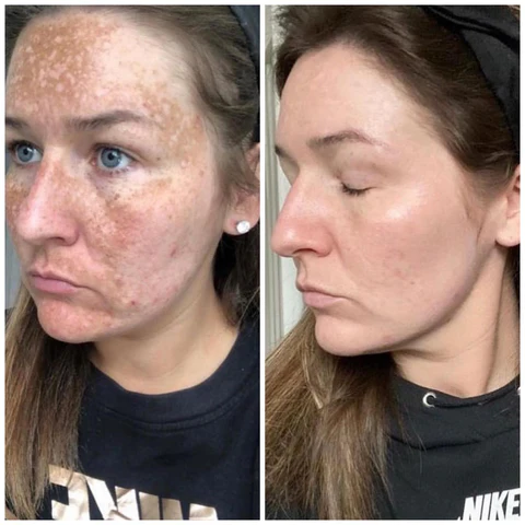 Fivfivgo Advanced Skin Brightening Serum