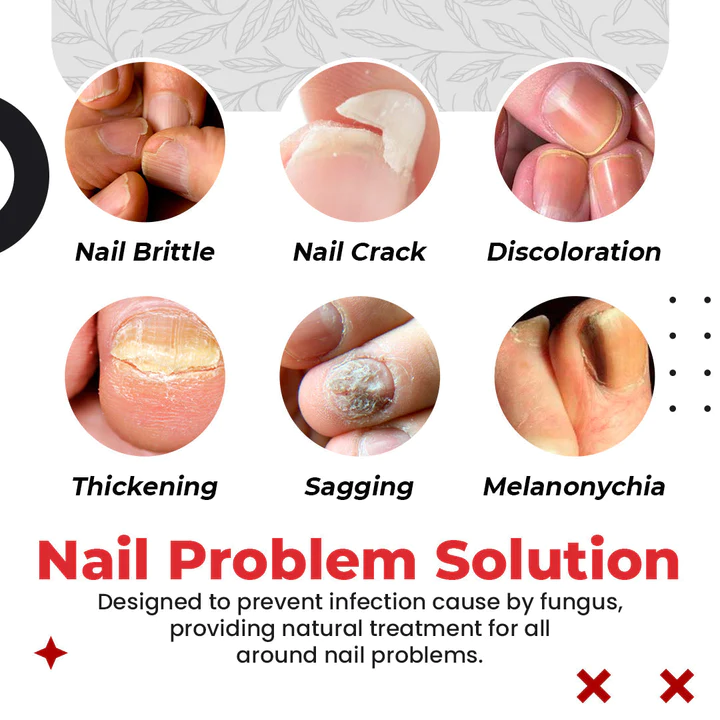 Toenail Pro Anti-Fungus Relief Oil