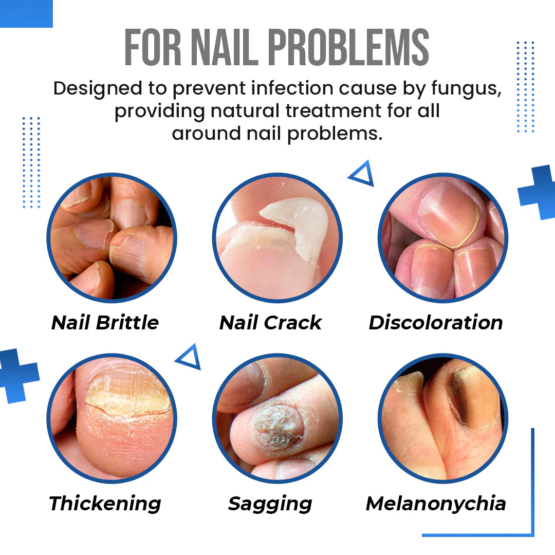 BioLab Anti Fungus Blue Light Laser Pen