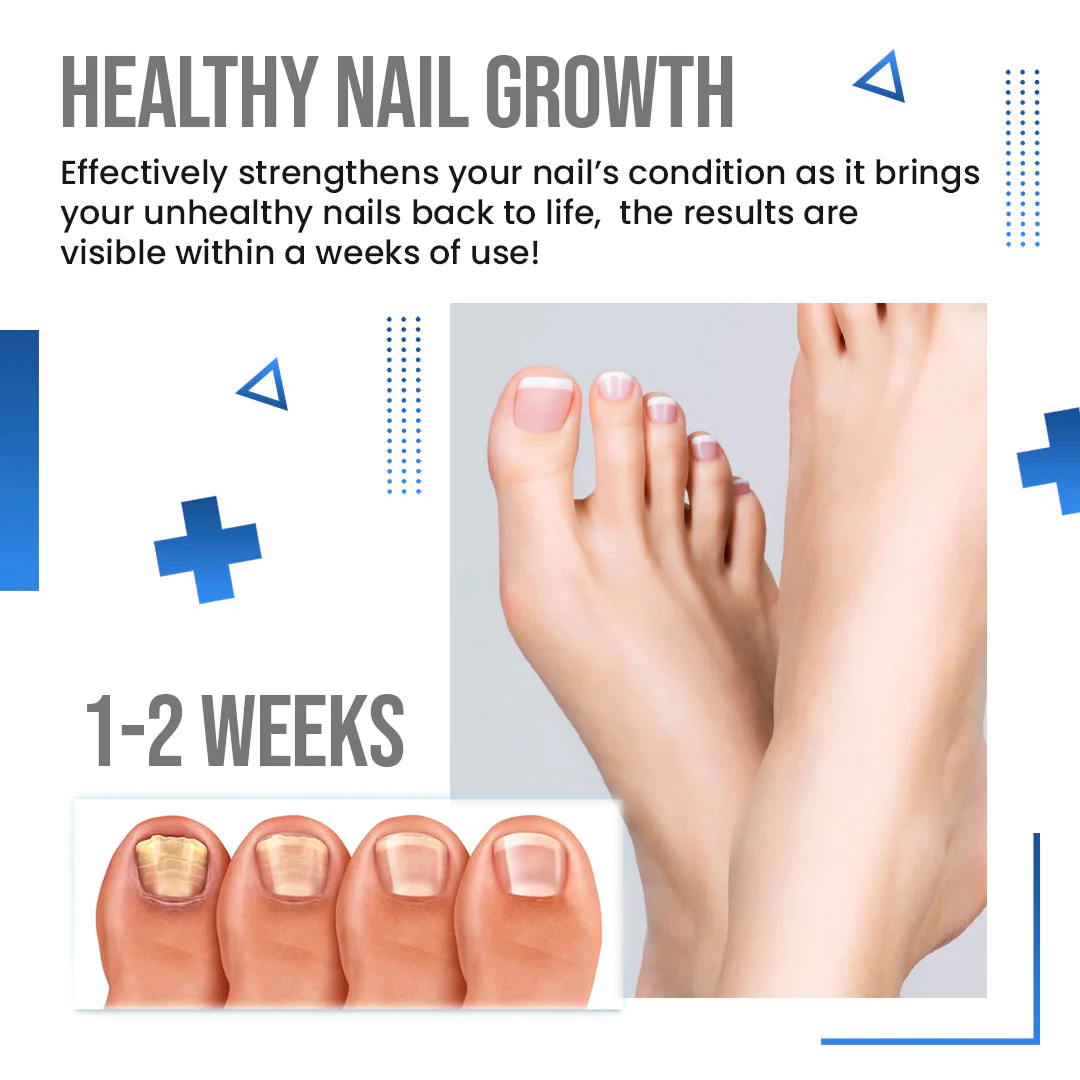 BioLab Anti Fungus Blue Light Laser Pen