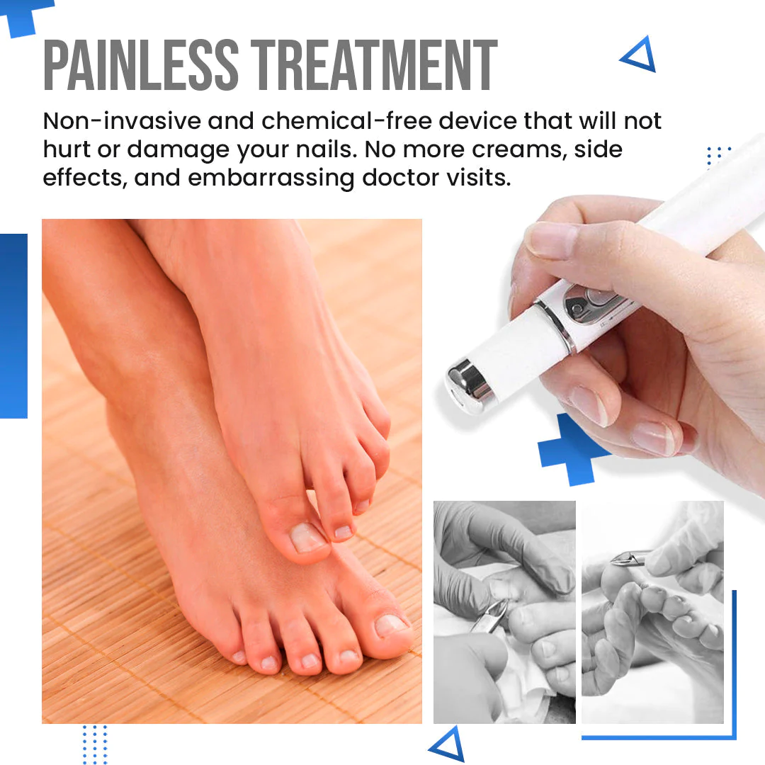 BioLab Anti Fungus Blue Light Laser Pen