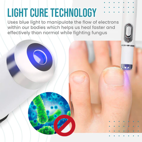 NailSpeed Laser Light Fungal Nail Pen