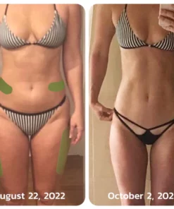 Oveallgo MugwortsLegs Cellulite Reduction Patches