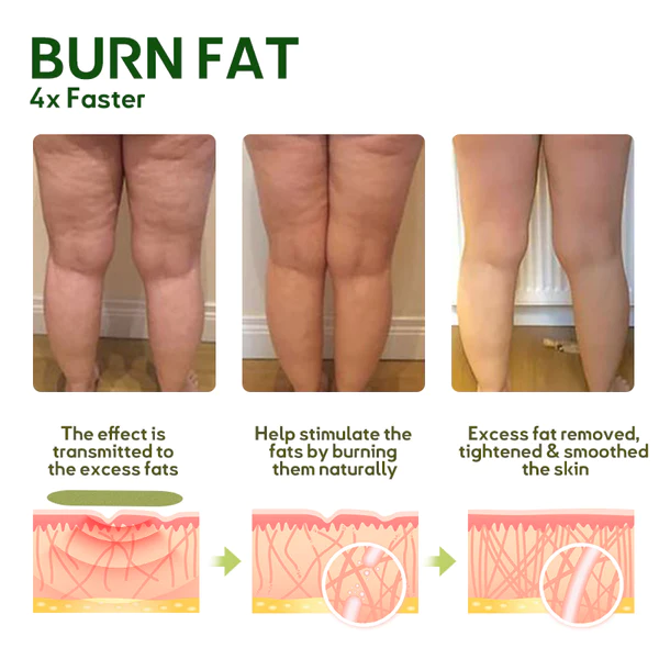 Oveallgo MugwortsLegs Cellulite Reduction Patches