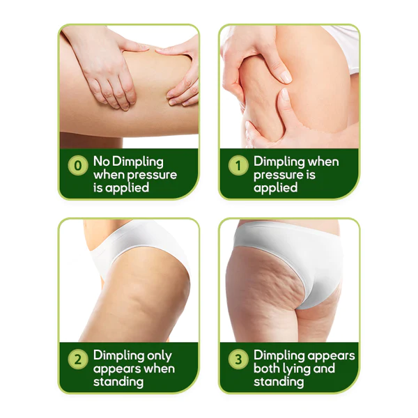 Oveallgo MugwortsLegs Cellulite Reduction Patches