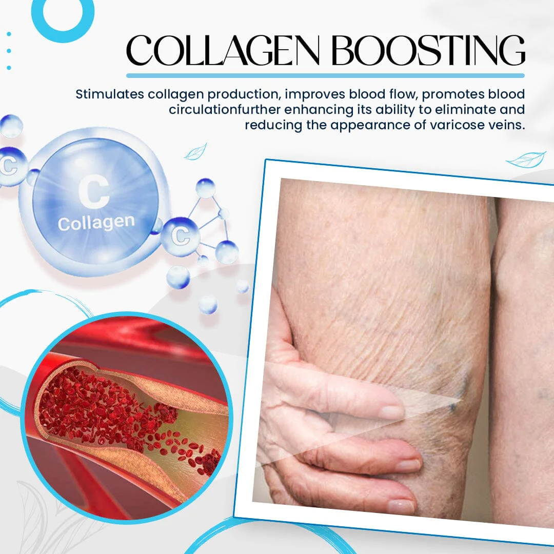 Raura Varicose Veins Treatment Cream