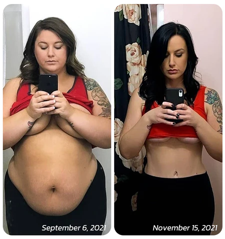 GFOUK Microcurrent Cryolipolysis Mini Massage Device