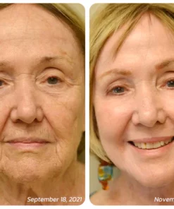 flysmus BotoxLUX Collagen Anti Aging Serum