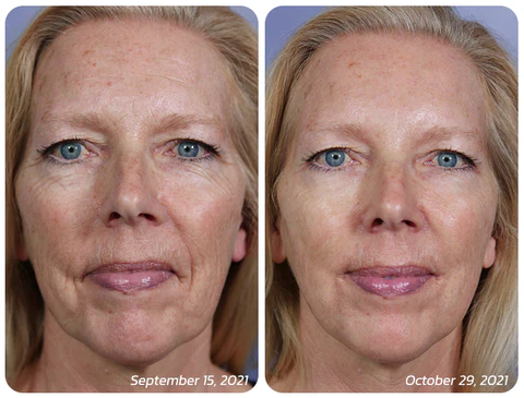 MsTimeless NMN Collagen Firming Gel