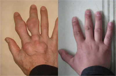 Juenow Powerful herbal drops for kidney support and uric acid cleansing