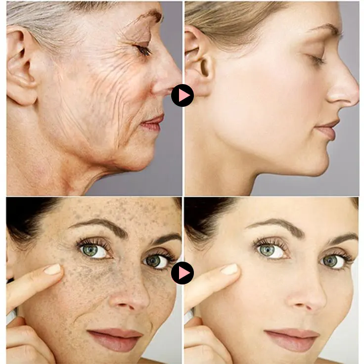 SKINREVIVE Collagen Boost Serum for Firmer, Younger-Looking Skin