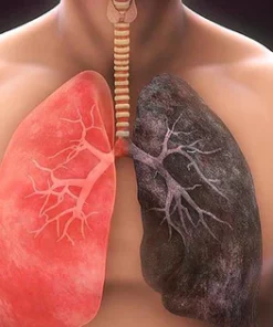 LungCareŽ Organic Herbal Lung Cleansing Spray