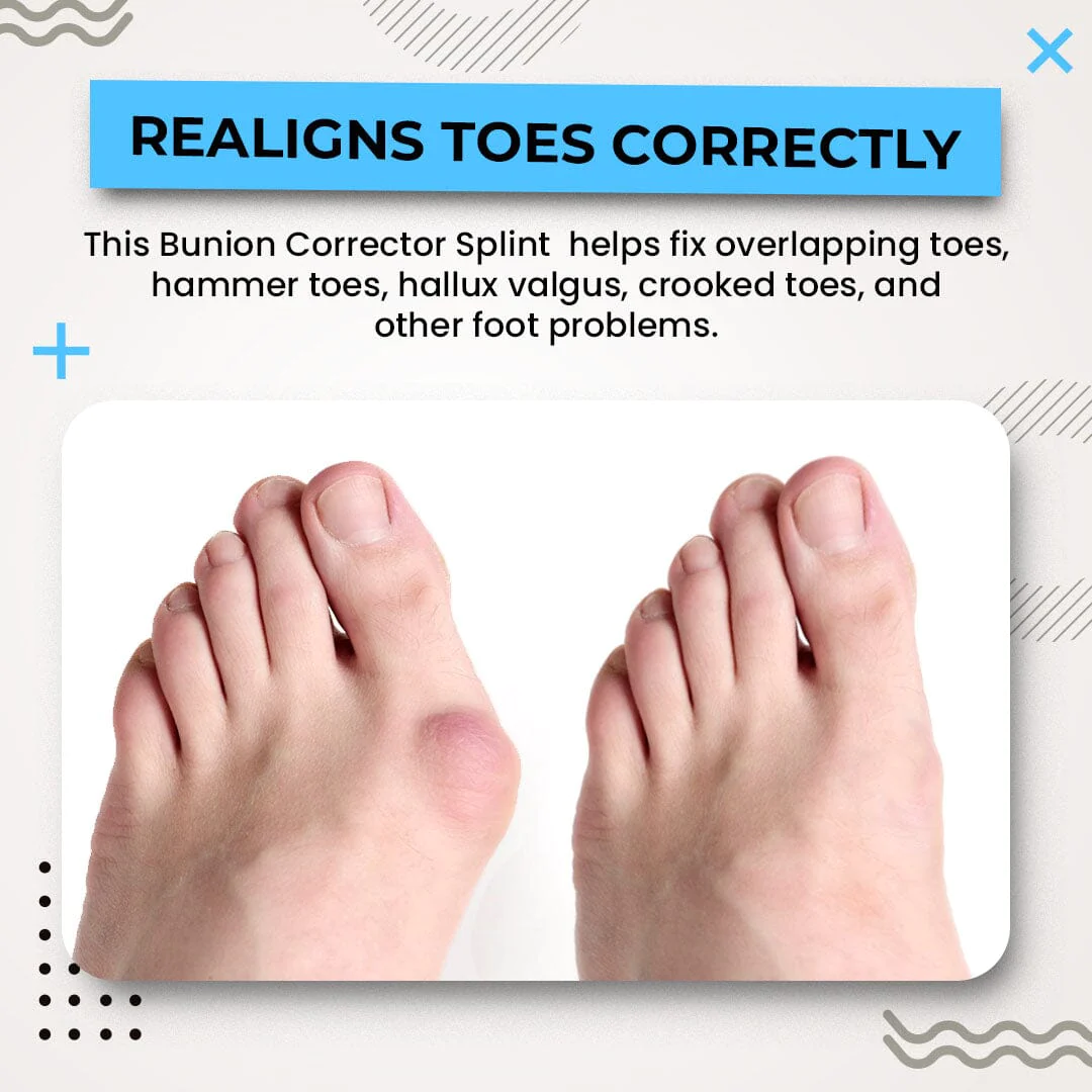 Drtoď¸ Bunion Splint Corrector
