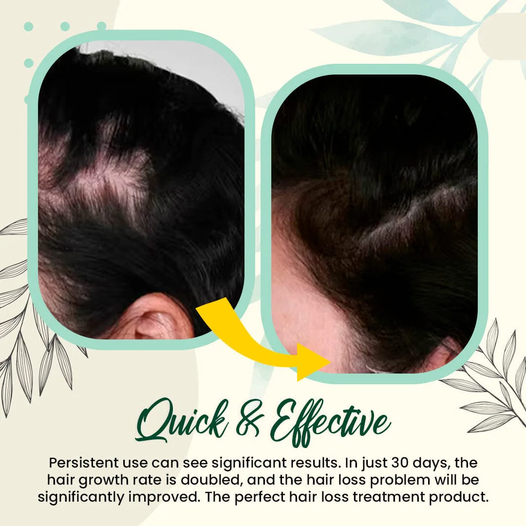 Biolab Japanese Hair Growth Spray