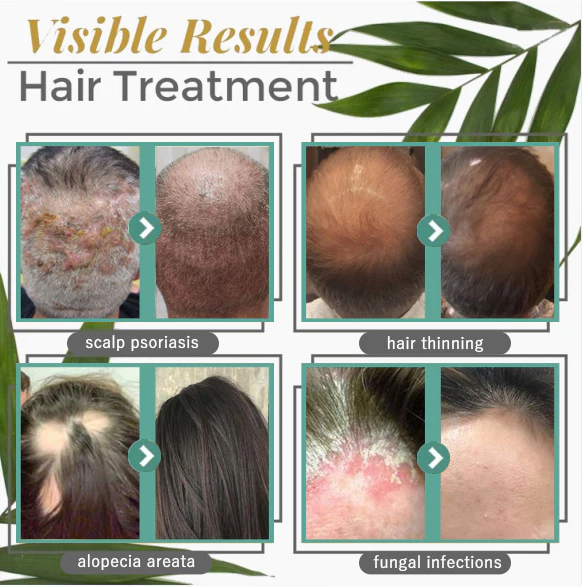 CPO Hair Grá´wth and Ná´urishing Serum