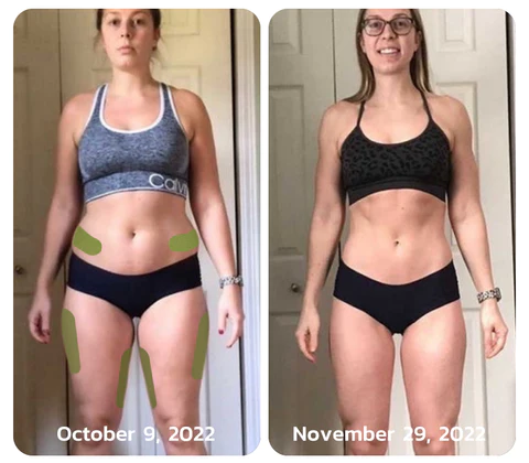 Oveallgo MugwortsLegs Cellulite Reduction Patches