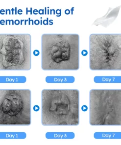 GFOUK Gentle Care Wipes