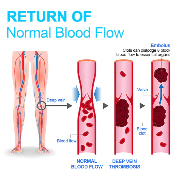 DAYIH Radiofrequency Herbal Thermal Knee Support
