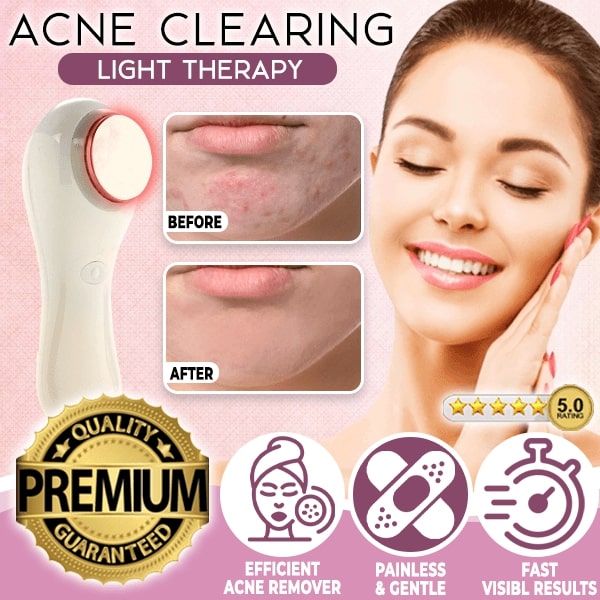 Acne Clearing Light Therapy