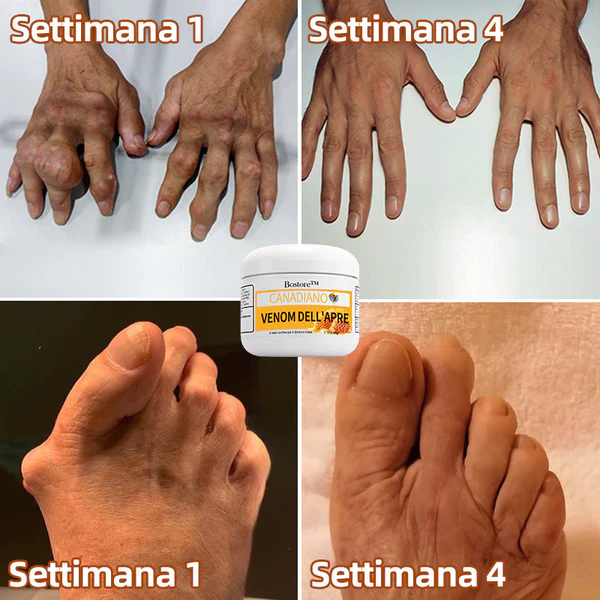 Bostore Canadian honey bee Venom Pain and Bone Healing Cream