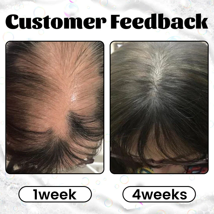 Ceoerty RevitaGinger Hair Boost Shampoo Bar