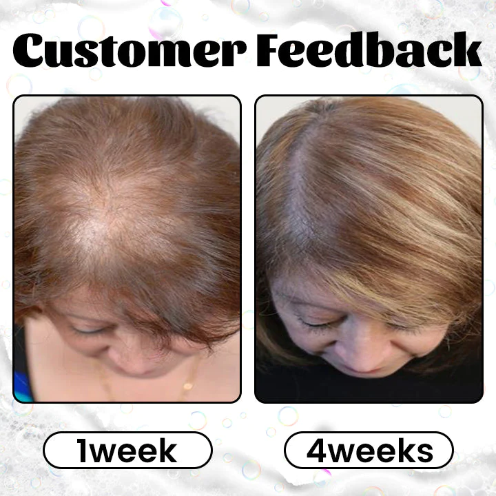 Ceoerty RevitaGinger Hair Boost Shampoo Bar