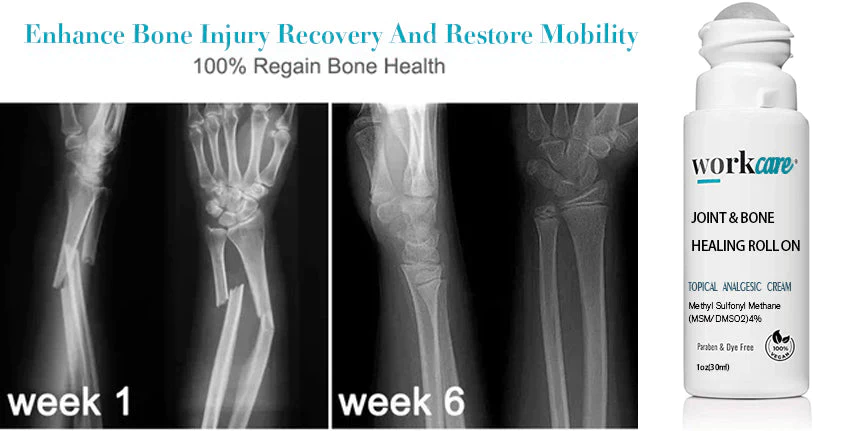 Workcare  Joint & Bone Healing Roll On