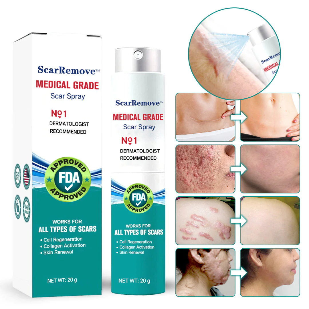 Oveallgo Advanced Scar Removal Spray