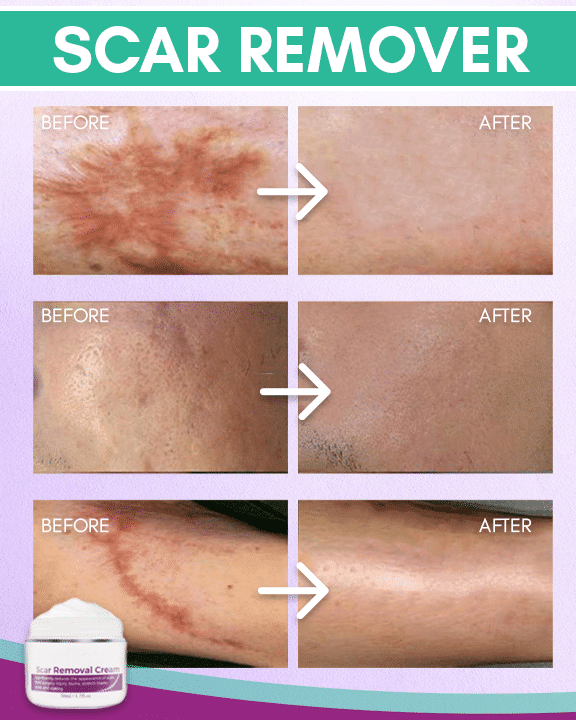 Comfy Heel Cushion Pads