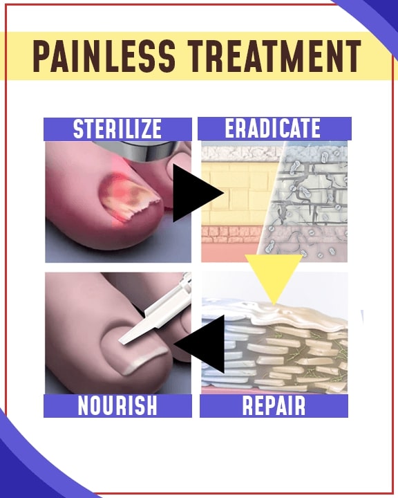 Fungal-out Blue Light Treatment Set