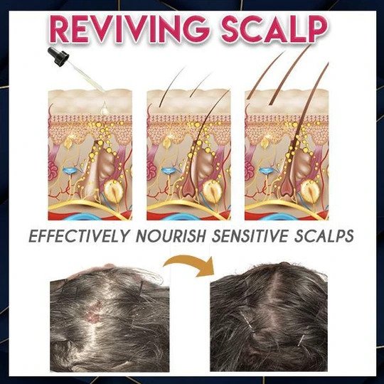 HOT SALE  Anti-skid cable ties for new portable vehicles