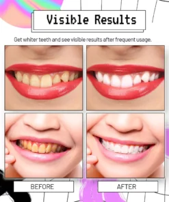 AngelSmile Whitening Purple Mousse Toothpaste