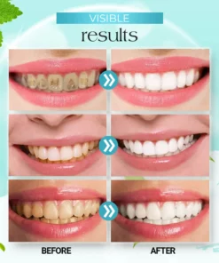 GarageLine Tooth Mousse