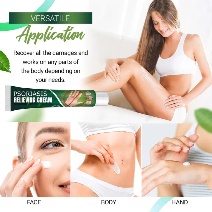 Psoriasis Relieving Cream