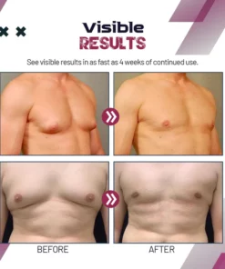 Fivfivgo Gynecomastia Reduction Spray