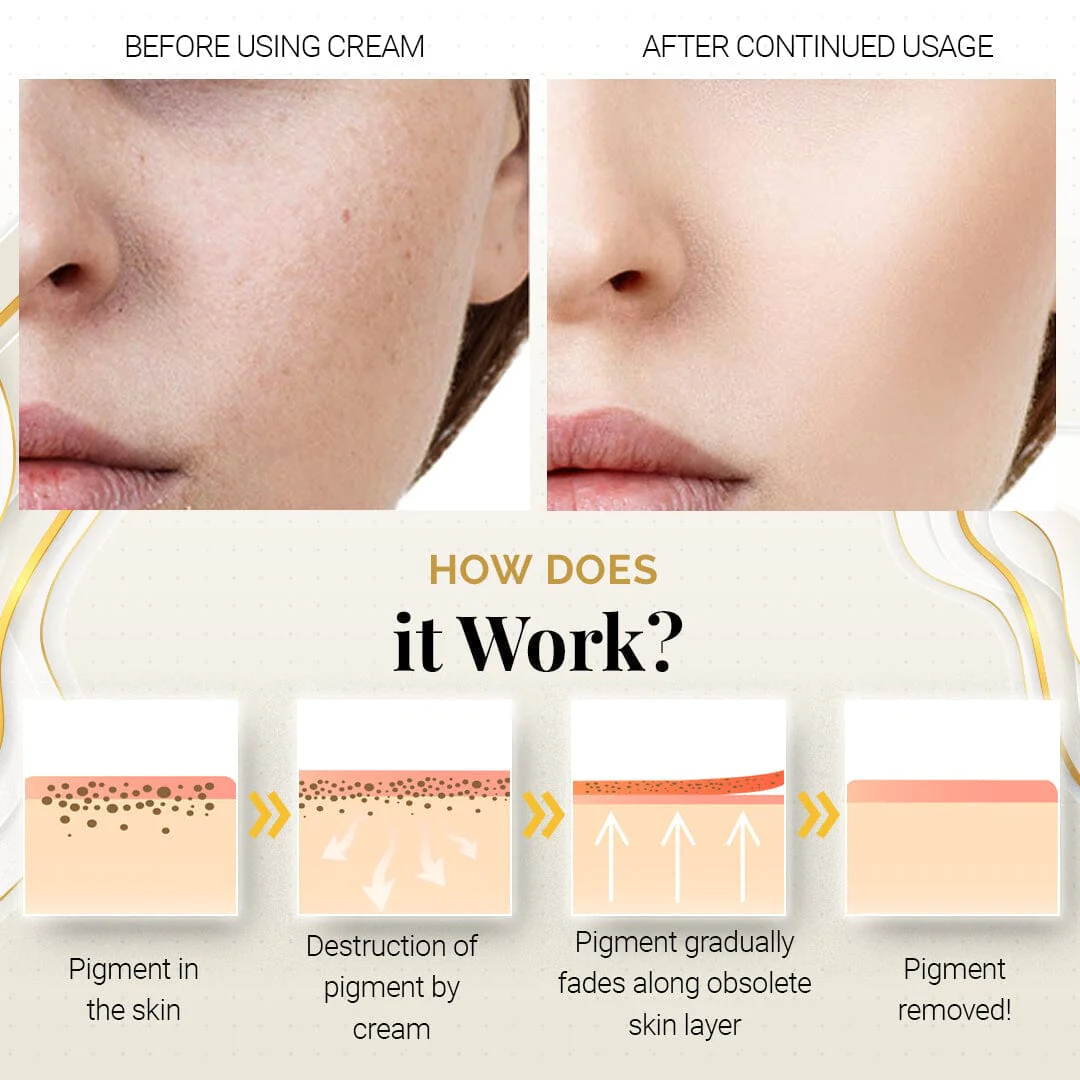 PureBright Korean High-Efficiency Corrective Whitening Spot Cream