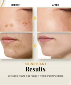 PureBright Korean High-Efficiency Corrective Whitening Spot Cream