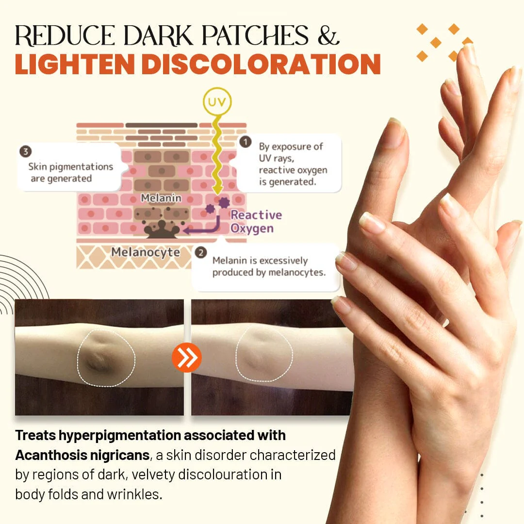 Zakdavi Acanthosis Nigricans Therapy Oil