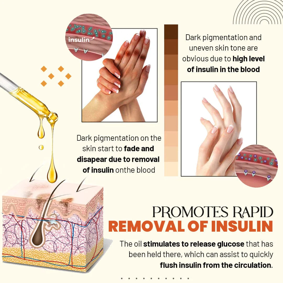 Zakdavi Acanthosis Nigricans Therapy Oil