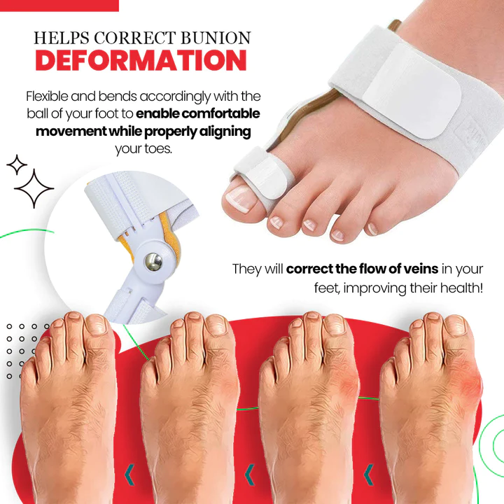 ToeAlign Bunion Cream & Corrector Set