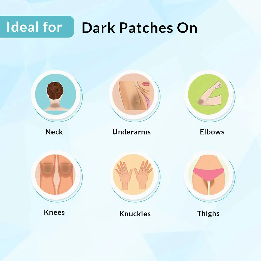 Nigrifree Acanthosis Nigricans Therapy Cream