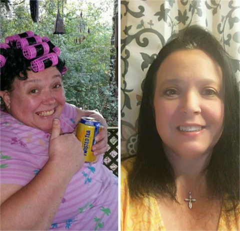 Fivfivgo Intensive Antioxidant Liver Cleansing Patches with Burst Beads