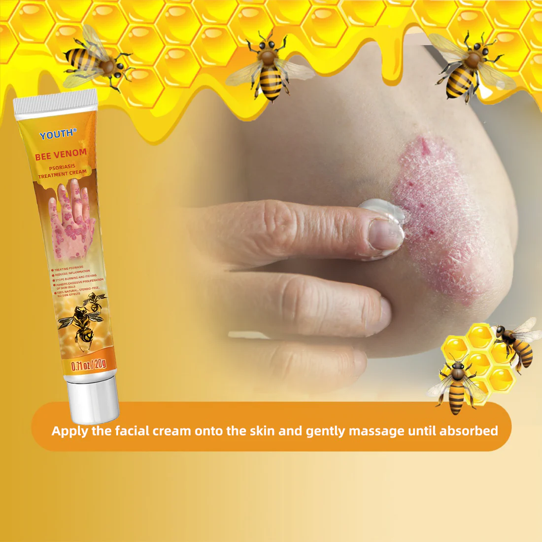 IFMAGIC Bee Venom Psoriasis Eczema Treatment Cream