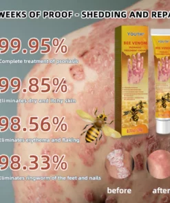 IFMAGIC Bee Venom Psoriasis Eczema Treatment Cream