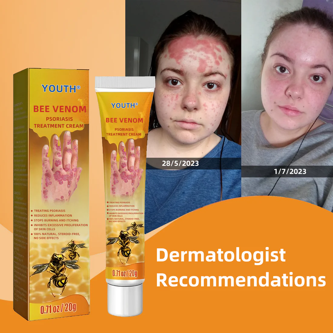 IFMAGIC Bee Venom Psoriasis Eczema Treatment Cream