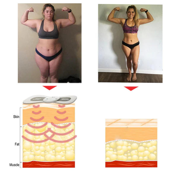 Ricpind Microcurrent HypertensionRelief Massager