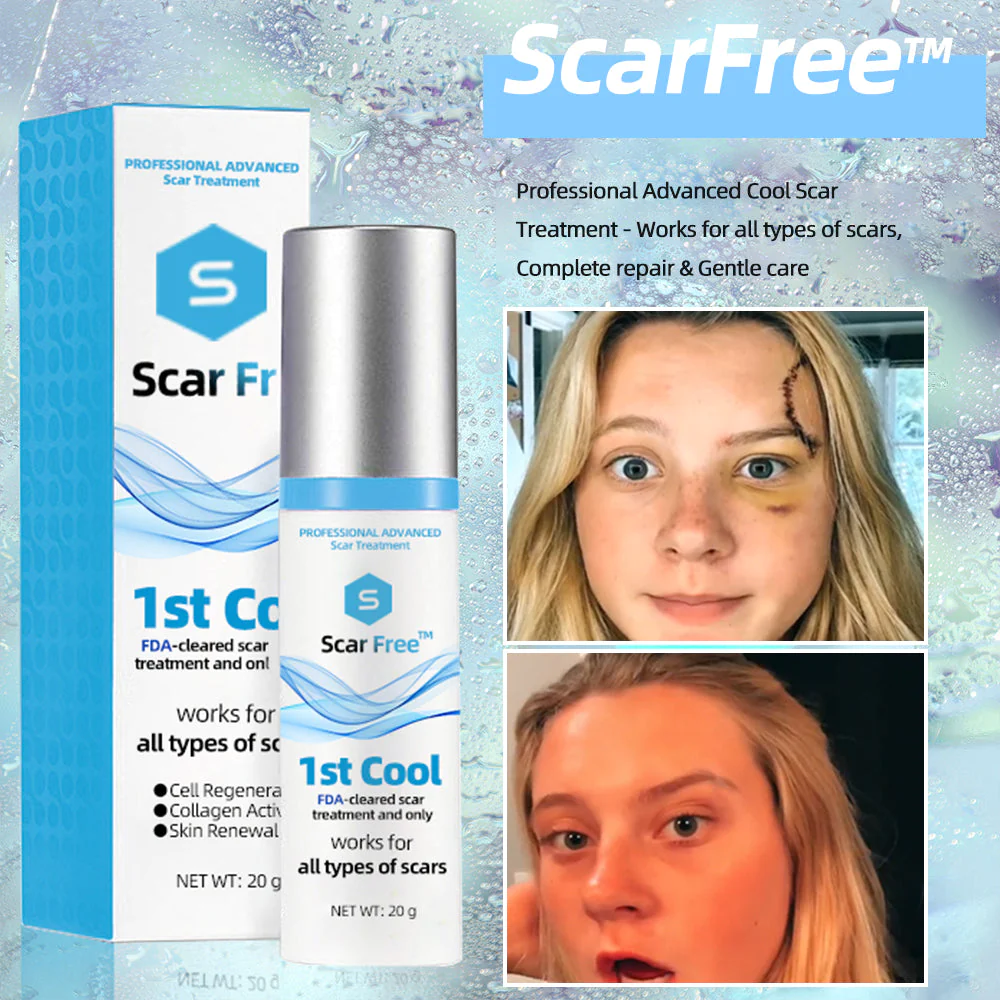 ScarFree Professional Advanced Cool Scar Treatment