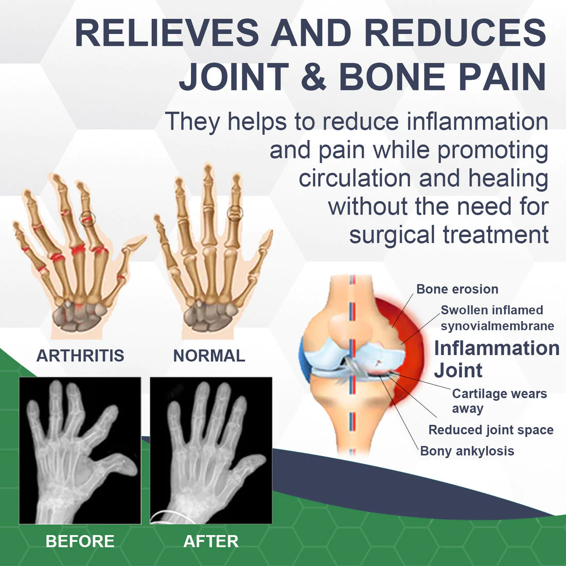 Oveallgo PRO Bee Venom Pain and Bone Healing Cream