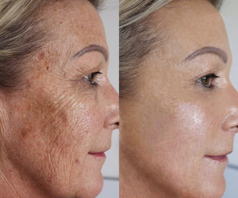 OSEE Advanced Deep Anti-wrinkle Serum